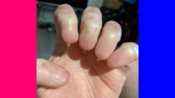 ஹய்யோ.. 5 விரல்களிலும் நகங்களே இல்லையே.. யார் இந்த நபர்.. அதிரவைக்கும் போட்டோ.. இதயமே நொறுங்குதே..!!