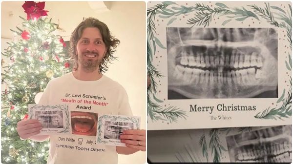 கிறிஸ்துமஸ் கிரீட்டிங் கார்டு.. சர்ப்ரைஸ் கொடுக்க நினைத்து பல்ப் வாங்கிய நபர்..தவறுதலாக எக்ஸ்ரே படம்