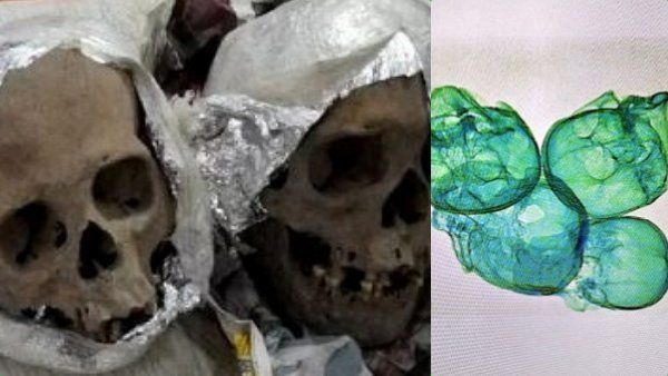 தகதகன்னு ஜொலித்த சில்வர் பார்சல்.. ஆர்வமாய் திறந்த ஆபீசர்ஸ்.. கடைசியில் குப்பென வியர்த்து போய்.. ஐயோ