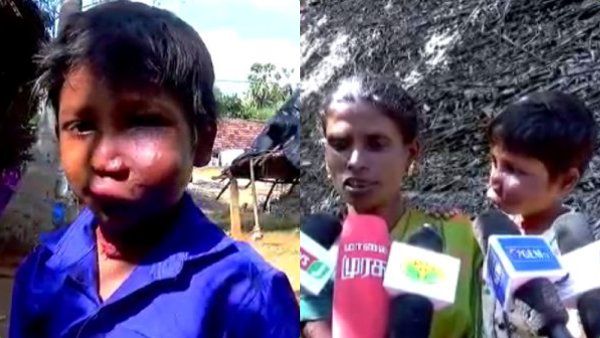 ஸ்டாலின் ஐயா.. உதவுங்க! சிதைந்த சிறுவன் முகம் - உள்ளே விடாத பள்ளி! சிகிச்சைக்கு பணமின்றி தவிப்பு