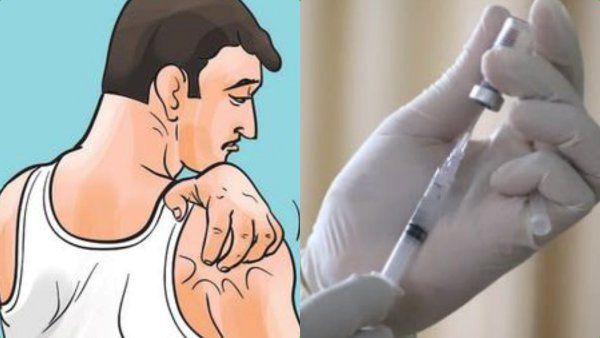 உடம்பெல்லாம் அரிக்குதுங்க.. மெடிக்கல் ஷாப்பில் மாத்திரை கேட்ட 