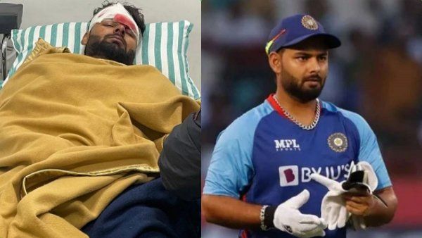 ரிஷப் பண்டிற்கு பிளாஸ்டிக் சர்ஜரி.. புருவத்தில் ஏற்பட்ட வெட்டுக்காயம்.. முக்கிய நிர்வாகி தகவல்!