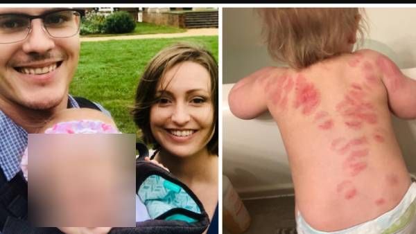 கொடூரத்தின் உச்சம்.. ஒன்றரை வயது குழந்தையை கடித்து குதறிய சைக்கோ.. ப்ளே ஸ்கூலில் 'அதிர்ச்சி'