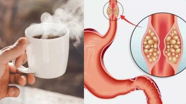 அதிக சூடாக டீ, காஃபி குடித்தால் இவ்ளோ பாதிப்புகளா? கேன்சர் கூட வருமா? ஷாக் கொடுக்கும் ஆய்வாளர்கள்!