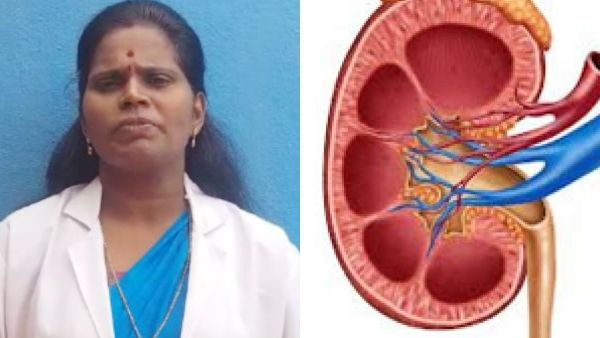 சிறுநீரகத்தில் கற்களால் அவதியா.. கவலையை விடுங்க.. 