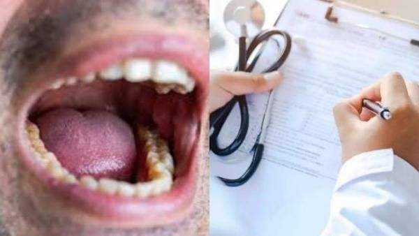 ரொம்ப முடியல! மருத்துவமனைக்கு ஓடிய நோயாளி! வாயை திறந்ததால்.. ஐய்யோ! கடைசியில இப்படி ஆகிடுச்சே!