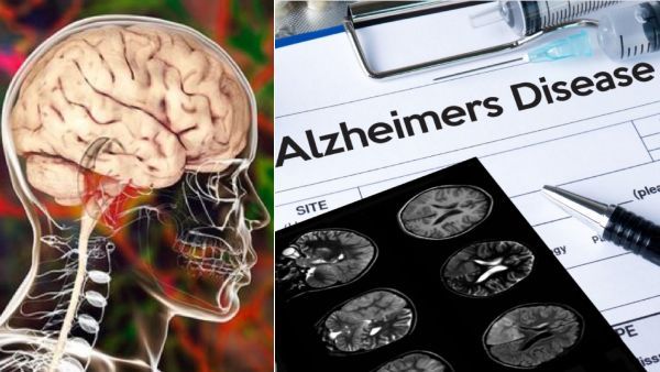 வயசு வெறும் 19.. முதியவர்களுக்கு ஏற்படும் மோசமான நோய்! இது எப்படி.. பார்த்து மிரளும் மருத்துவர்கள்