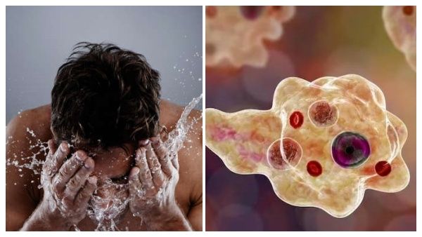 ஆ..ஆ.. துடிதுடித்து இறந்த இளைஞர்.. முகம் கழுவியபோது கொடுமை..பாதி மூளையை காணோமே..ஷாக்கில் அமெரிக்கா