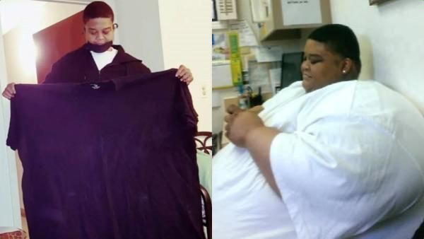 டாக்டர் சொன்ன அந்த வார்த்தை.. 300 கிலோ உடல் எடை பாதியாக குறைப்பு.. ஹேப்பிதான் ஆனாலும் ஒரு சோகம்