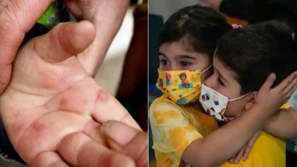 அப்போ இது வெறும் ப்ளூ காய்ச்சல் இல்லையா..? கர்நாடகாவிலும் நிரம்பி வழியும் மருத்துவமனைகள்