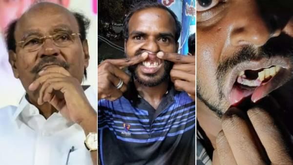 பல்லை பிடுங்கி, உயிர்நாடியில் தாக்கி.. என்ன மனநிலை? பல்வீர் சிங்கின் பவரை புடுங்குங்க.. ராமதாஸ்