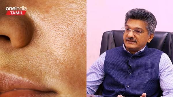 வெயிலால் கருத்த முகத்தை சிவப்பாக்க பேஷியல் செய்யலாமா.. என்ன சோப்பை பயன்படுத்தலாம்.. டாக்டர் டிப்ஸ்!
