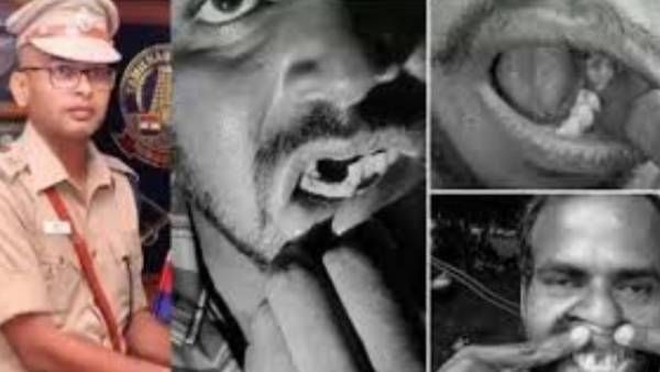 பல் பிடுங்கிய பல்வீர் சிங்.. அதுவும் 