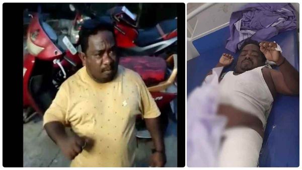 அவங்க காலு உயரம் கூட இல்லன்னு கேலி செய்தாங்க.. என் காலை உடைச்சது 3 போலீஸ்.. குட்டி நாகராஜ் பரபரப்பு