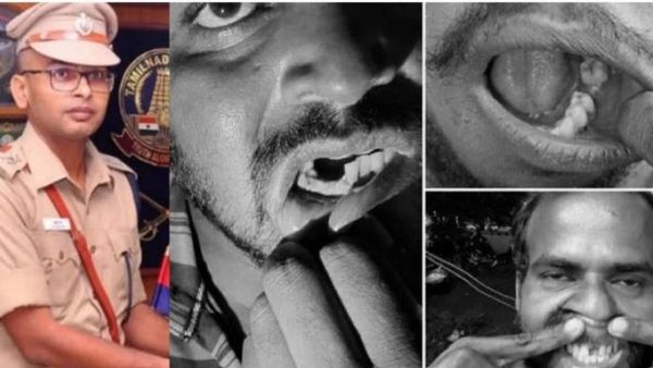 பல் பிடுங்கிய விவகாரம்.. வெயிட்டிங் லிஸ்ட் போலீசார் 3 பேருக்கு மீண்டும் பணி.. டிஎஸ்பி அதிரடி உத்தரவு