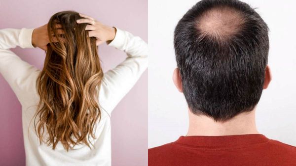 கருங்கூந்தல் அழகு..இளமையிலேயே வழுக்கையா? இளநரை நீங்க எளிமையான ஜோதிட பரிகாரம் இருக்கு