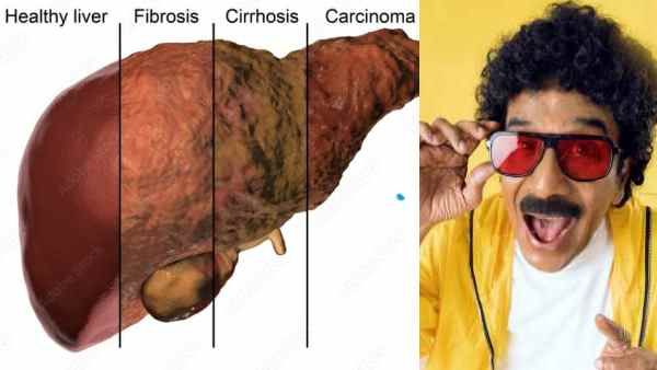 எல்லோரையும் சிரிக்க வைக்க மனோபாலா..கல்லீரலை கவனிக்காமல் விட்டது ஏன்? இதை மறக்காம சாப்பிடுங்க