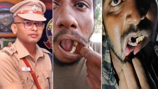 பற்களை பிடுங்கிய விவகாரம்: 24 போலீசார் மீது அதிரடி நடவடிக்கை.. நெல்லை மாவட்ட எஸ்.பி உத்தரவு!