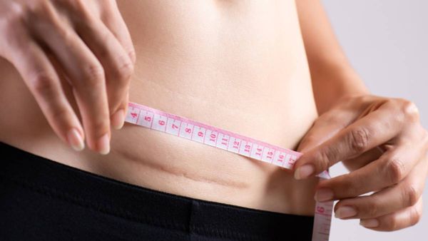 சிசேரியன் பிரசவம்..வெள்ளைப்பூண்டு..சுக்குக்களி..சத்தா சாப்பிடுங்க..உடம்பு சிக்குன்னு இருக்கும்!