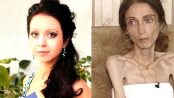 ‛டயட்’.. எப்படி இருந்தவர் இப்படி மாறிட்டாங்க பாருங்க! கணவர் சொன்ன ஒற்றை வார்த்தை! சிக்கலில் பெண்