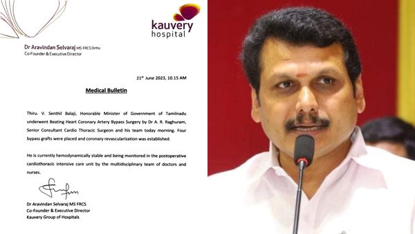 இதய தமனி பைபாஸ் ஆபரேசன்..எப்படி இருக்கிறார் செந்தில் பாலாஜி?..காவேரி மருத்துவமனை அறிக்கை
