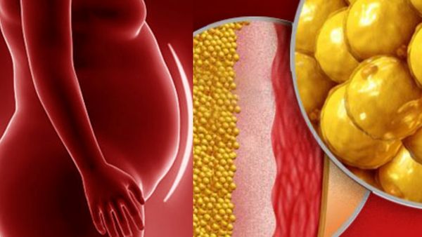 தொந்தியும் தொப்பையுமா இருக்கீங்களா.. உடல்எடை குறைய 