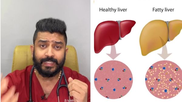 நீங்க மது குடிக்காட்டியும் 