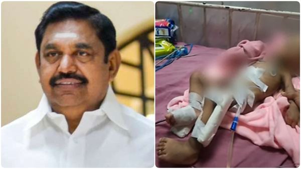 எதிர்காலத்தை இழந்த ஒன்றரை வயது குழந்தை.. ரூ.50 லட்சம் வழங்க வேண்டும்.. எடப்பாடி பழனிசாமி கோரிக்கை