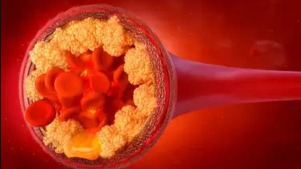 குண்டு குண்டுனு இருக்கீங்களா? அப்ப 