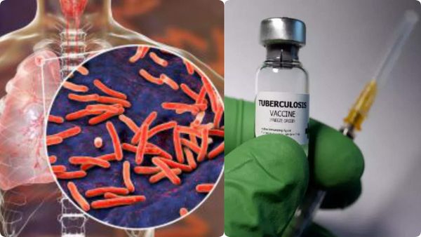 குட்நியூஸ்.. அடுத்த 100 ஆண்டுக்கு கவலை வேண்டாம்! காசநோய்க்கு வரும் புதிய தடுப்பூசி! 3ம் கட்ட சோதனை