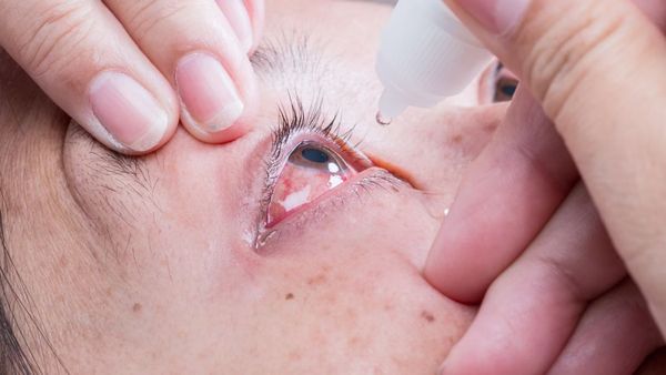 அடுத்தடுத்து சிவக்கும் கண்கள்.. திடீரென மாறிய வானிலையால்.. மக்களுக்கு ஏற்பட்ட பாதிப்பு.. ரொம்ப கவனம்