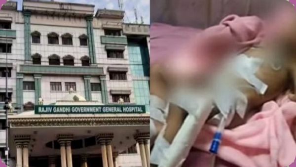 கை அகற்றப்பட்ட ராமநாதபுரம் குழந்தை இறப்பு ஏன்? உடல் முழுவதும் பரவிய தொற்று.. மருத்துவர்கள் விளக்கம்