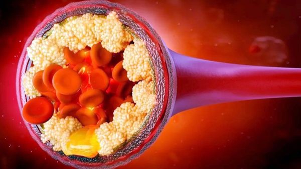 குண்டு குண்டுன்னு இருக்கிறீங்களா? இதோ 