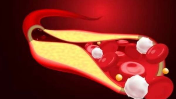 குண்டு குண்டுனு ஆயிட்டீங்களா.. அப்ப இந்த மேஜிக் 