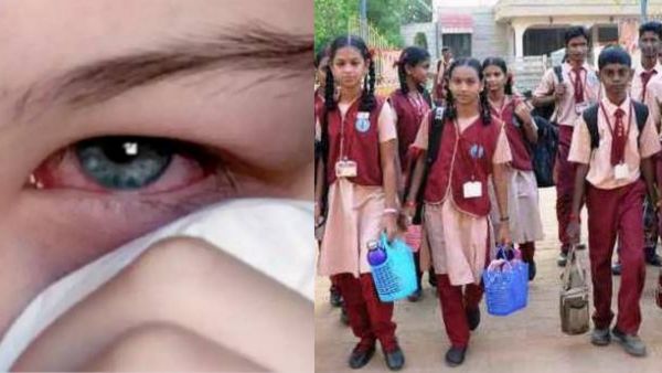 சைலன்ட்டாக பரவும் மெட்ராஸ் ஐ.. இன்று முதல் 25 ஆம் தேதி வரை சென்னை பள்ளி மாணவர்களுக்கு கண் பரிசோதனை