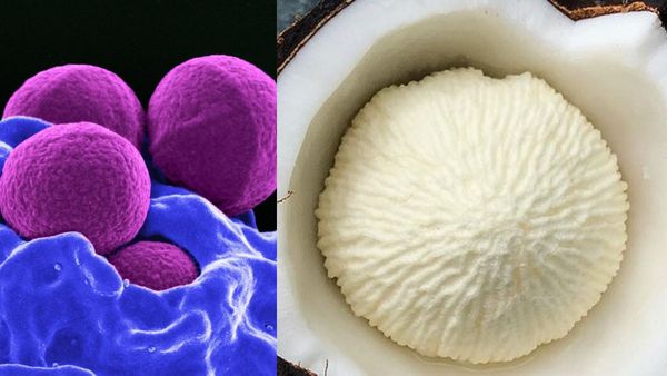 கல்லீரல் பலம் பெற.. நார்ச்சத்து + நீர்ச்சத்துடன் தேங்காய் பூக்கள்... அதென்ன தேங்காய் முட்டை.. அருமை