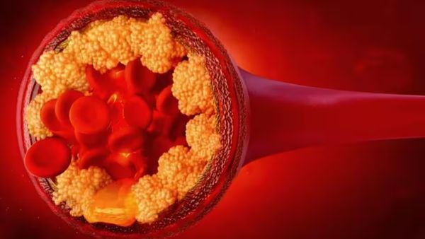 கொழு கொழு கொழுப்பை.. கடகடனு கரைக்கும் 