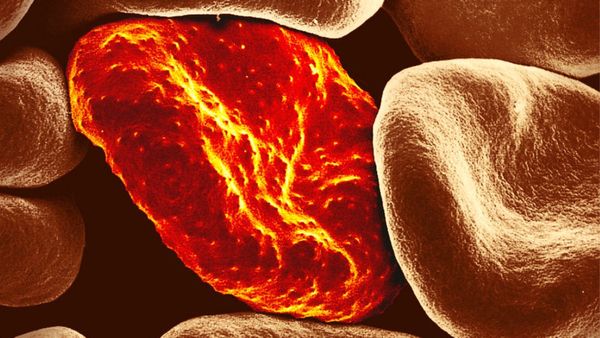 சட்டுனு வெயிட் குறையணுமா.. இதை மட்டும் சாப்பிடுங்க.. ஈஸியா ஒல்லியாயிடலாம்.. பெஸ்ட் காலை உணவு இதுதான்