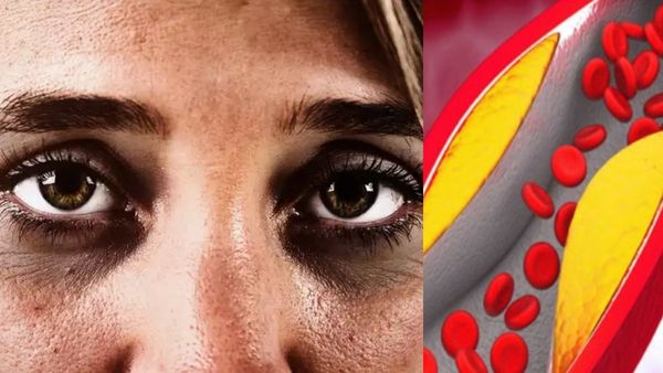 கண்ணெல்லாம் கருவளையம்.. கண்களை சுற்றி கருப்பா இருக்கா..வாழைப்பழம் இருக்குதுல்ல.. செம டிப்ஸ் பாருங்க