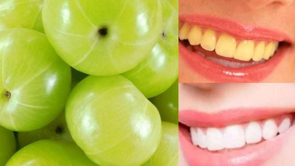 பல்லெல்லாம் 