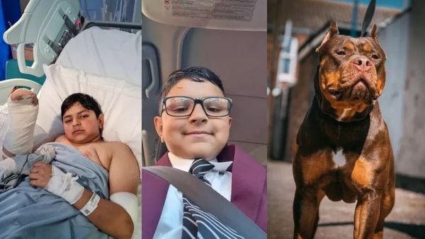 12 வயது சிறுவனை கொடூரமாக தாக்கிய தெரு நாய்.. இறந்துவிட்டதாக கலங்கிய அக்கம் பக்கத்தினர்.. என்ன நடந்தது?