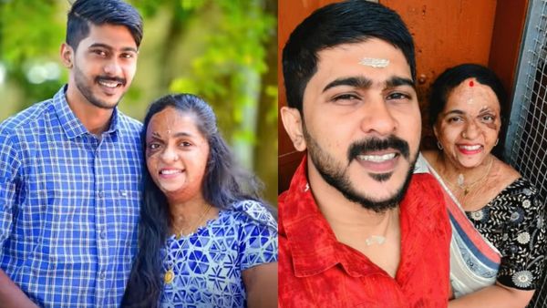 10 வயதில் ஏற்பட்ட தீ விபத்து.. மருந்தாய் மலர்ந்த நிஜ காதல்.. இந்த கேரள ஜோடிக்கு இத்தனை கஷ்டங்களா?