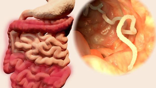 ஆசனவாய் அரிப்பா.. குடல்புழுக்கள் தொல்லையா.. சூப்பர் டிப்ஸ் நோட் பண்ணுங்க.. கைவசம் இருக்கு வீட்டுவைத்தியம்