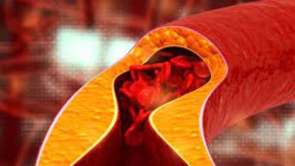 கொழு கொழு தொப்பை குறைய.. இந்த 5 பொருள் மட்டுமே போதும்.. கண்ணெதிரே உடல் எடை சூப்பரா குறையும் பாருங்க