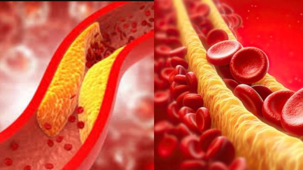 வெறும் வயிற்றில் பழங்களை சாப்பிடலாமா.. இந்த பழமா? அடடே இது தெரியாம போச்சே.. ஆச்சரியம் தரும் நிஜங்கள்