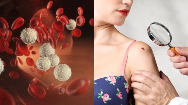 இந்த அறிகுறிகள் இருக்கா? சாதாரண கட்டியையும் அலட்சியப்படுத்தாதீங்க.. கலர்ஃபுல் பழங்களை கையிலெடுங்க