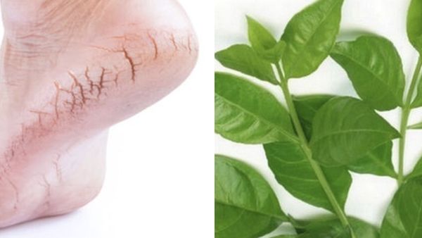 வெறும் மருதாணி இலை.. காலில் பித்த வெடிப்பை போக்க இந்த எண்ணெய்யே போதும்.. பாத வெடிப்புகளுக்கு மஞ்சள்