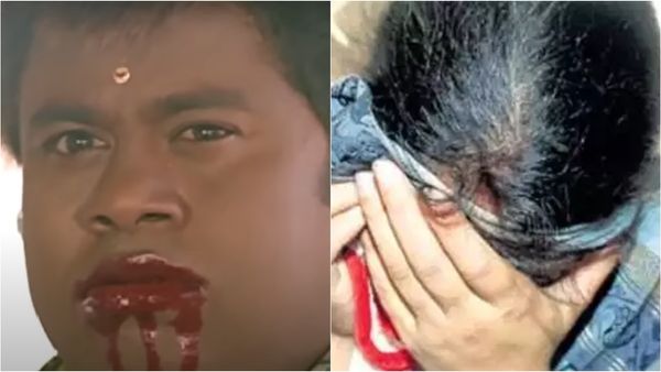 திடீரென பின்னால் ஓடி வந்து.. கணவனின் காதைக் கடித்து துப்பிய மனைவி.. அடுத்து நடந்த ட்விஸ்ட்