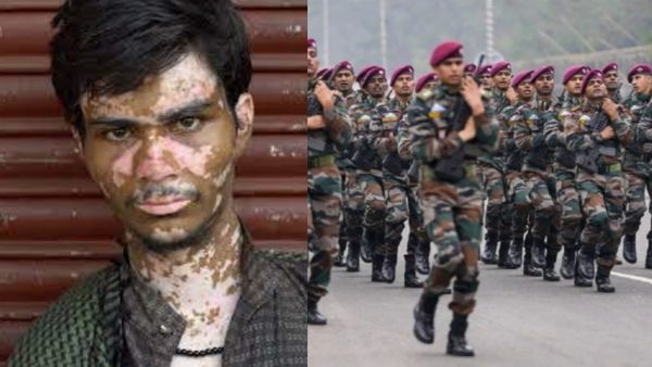 வெள்ளை தழும்பு உள்ளவர்களை ராணுவத்தில் பணியாற்ற அனுமதியுங்கள்.. திமுக எம்.பி வைத்த முக்கிய கோரிக்கை!