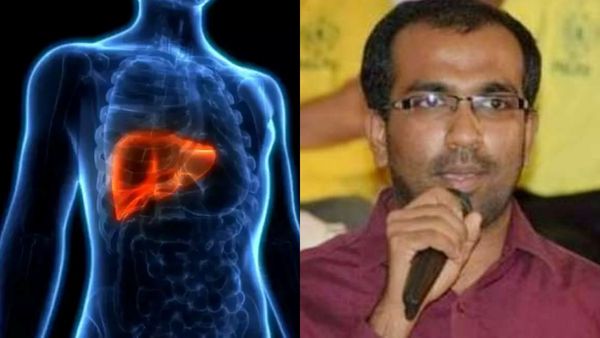 கொழுப்பு சாப்பிட்டால் ஃபேட்டி லிவர் வருமா? அந்த 